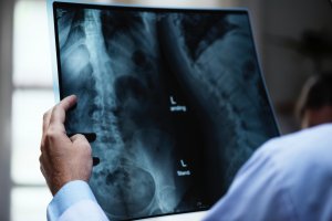 Causes, Symptoms, and Treatment for Broken Rib Injuries following a Truck Accident